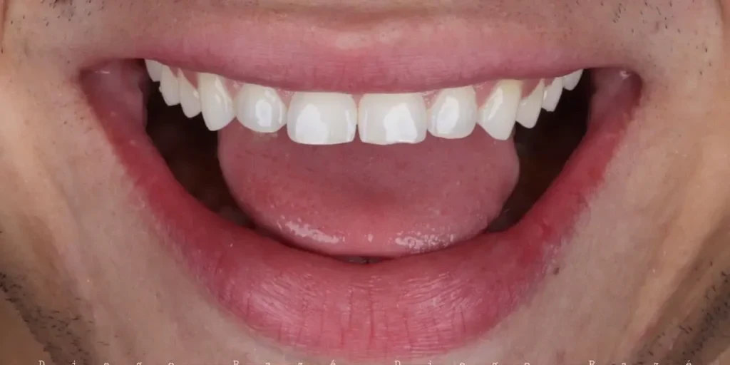 Sorriso antes do tratamento